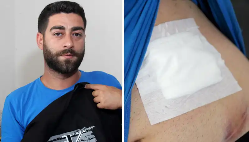 Karnındaki Ağrı İçin Hekime Danıştı, Röntgen Sonucu Şoke Etti