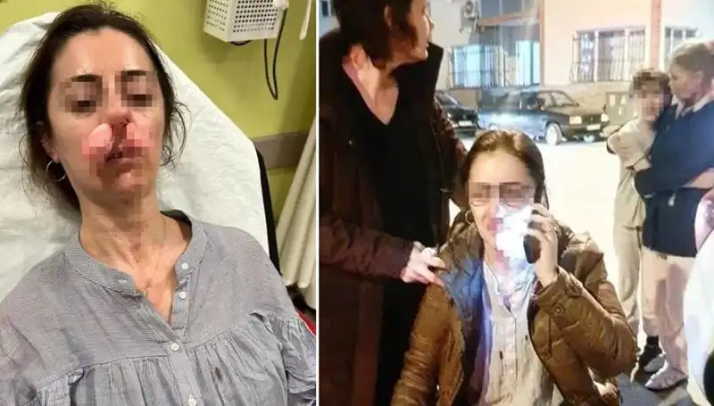 Eşinin Sevgilisini Araba Kapısıyla Vurdu: Olayda Silah Değerlendirmesi!
