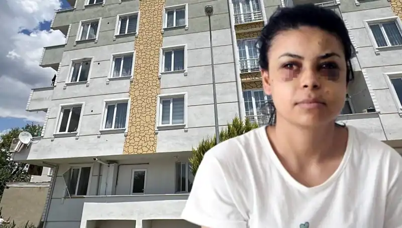 Düğün Dönüşü Korkunç Bir Olay: Maganda Kurşunları Genç Kızı Vurdu